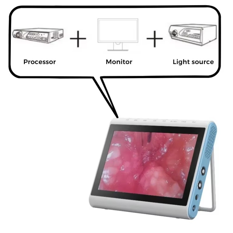 3‑In‑1 Medical Endoscopy Image - огляд і ціна Medical Lab Images