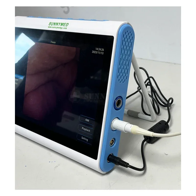 3‑In‑1 Medical Endoscopy Image - огляд і ціна Medical Lab Images