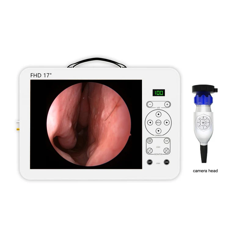 17 Inch HD Video Otoscope ENT  - огляд і ціна Medical Lab Images