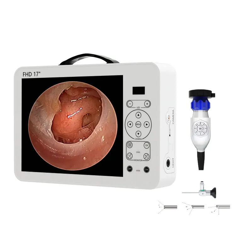 17 Inch HD Video Otoscope ENT  - огляд і ціна Medical Lab Images