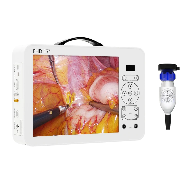 17 Inch HD Video Otoscope ENT  - огляд і ціна Medical Lab Images